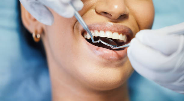Best Emergency Cosmetic Dentistry (e.g., broken veneers) in Mbria, CA