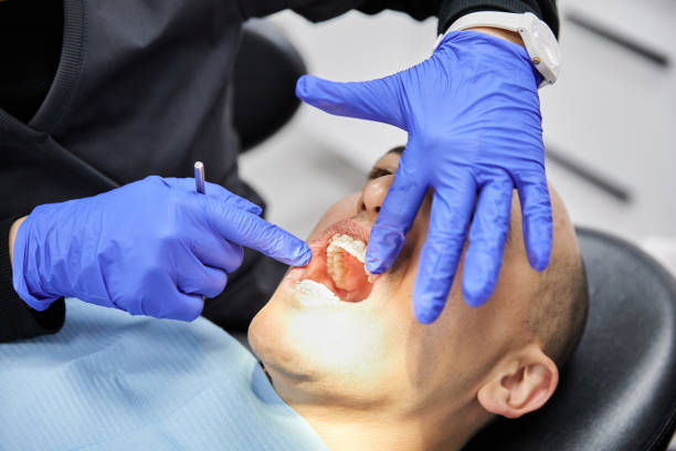 Best Walk-In Emergency Dental Services in Mbria, CA